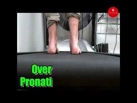🌟 Discover the secrets of perfect running posture! 🏃‍♂️ Is overpronation holding you back? Let's