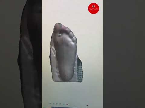 How a 3D Foot Scan Starts a Custom Orthotic