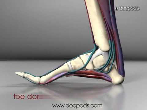 What is the Windlass Mechanism in Your Foot?