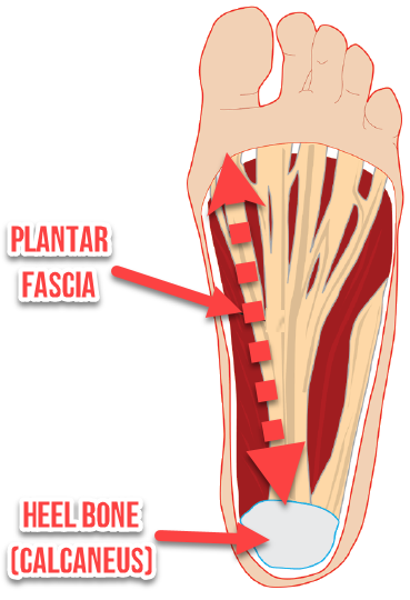 Plantar fasciitis and heel pain occur when the arches collapse and the ligaments are strained in the feet.  Orthotic insoles can be effective for pain relief.